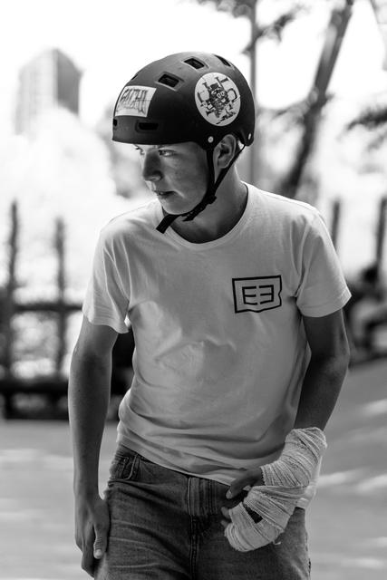 Young athlete wearing protective helmet and bandaged hand, gazing to the side with focused expression at outdoor venue